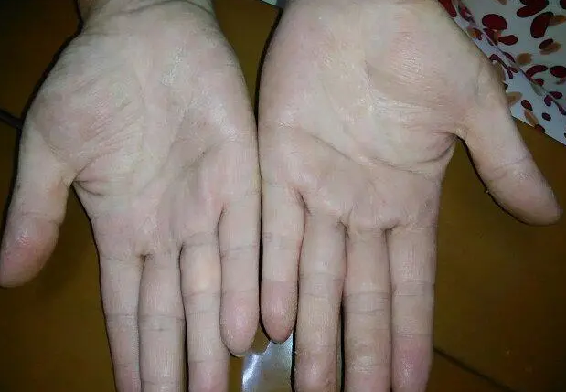 手掌和脚掌对养生有哪些好处